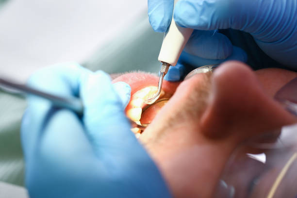 Best Emergency Dentist for Special Needs Patients in Metamora, IL