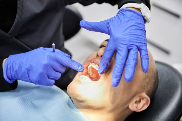 Best Emergency Dentist for Knocked-Out Tooth in Metamora, IL
