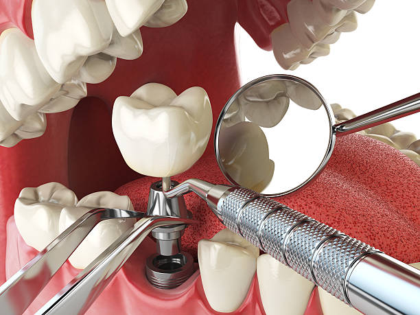 Best Pediatric Emergency Dentist in Metamora, IL